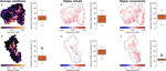 From Soil Moisture Spatial Patterns to Catchment Nitrate Dynamics Using Explainable AI